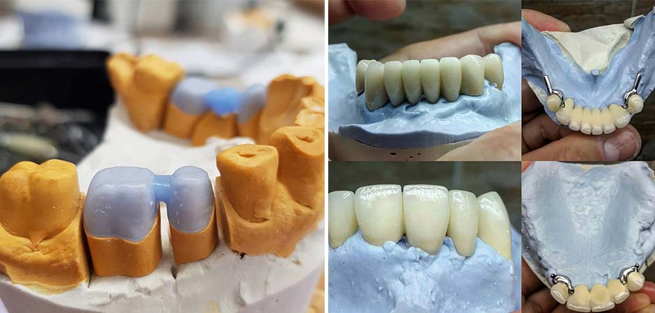 LABORATORIJA ZA ZUBNU TEHNIKU VE&MI DENT ART NIŠ